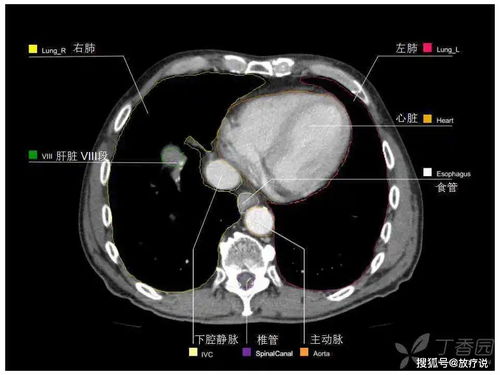 经典高清 最实用的上腹部 CT 影像解剖图谱,看过的医生都收藏了